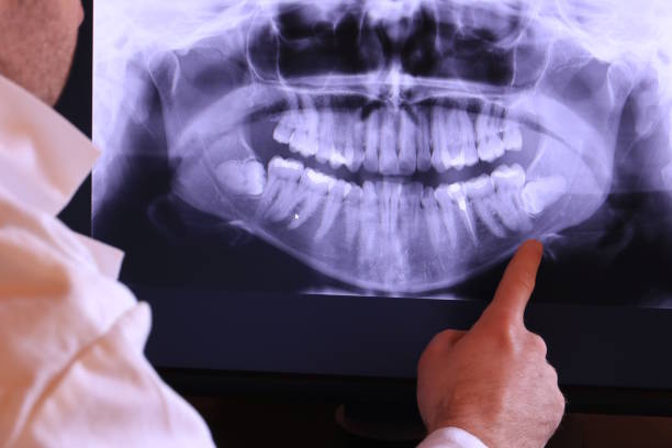 Best Urgent Tooth Repair  in Old Fig Garden, CA