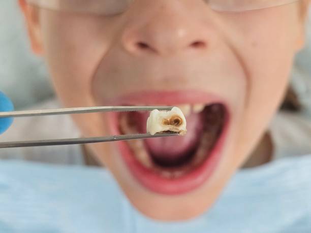 Best Emergency Pediatric Dentist  in Old Fig Garden, CA